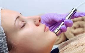 microdermabrasion